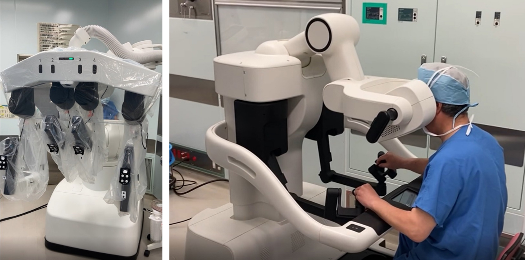 手術支援ロボットhinotoriと手術中の操作の様子